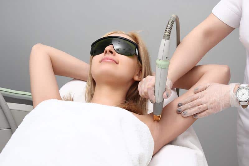 A woman lying down receives laser hair removal treatment on her underarm. She is wearing protective goggles while a skilled technician, donning gloves, expertly operates the laser device. A towel covers her torso, reminiscent of precision found in acne scar removal treatments.